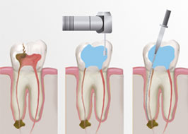 Endodontics