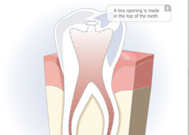 Endodontics_2