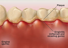 Periodontics